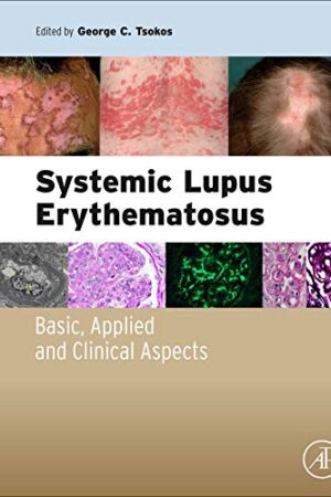 Systemic Lupus Erythematosus: Basic, Applied and Clinical Aspects