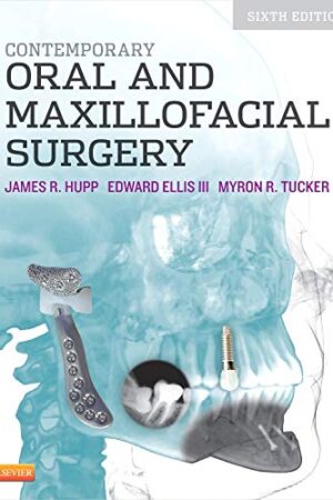 Contemporary Oral and Maxillofacial Surgery