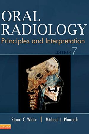 Oral Radiology: Principles and Interpretation