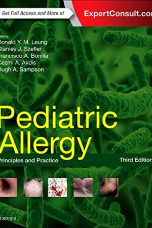 Pediatric Allergy: Principles and Practice