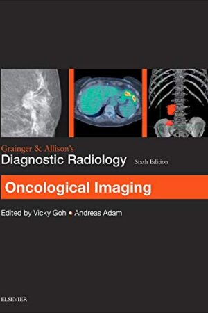 Grainger & Allison`s Diagnostic Radiology: Oncological Imaging