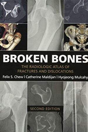 Broken Bones: The Radiologic Atlas of Fractures and Dislocations