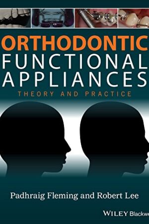 Orthodontic Functional Appliances: Theory and Practice