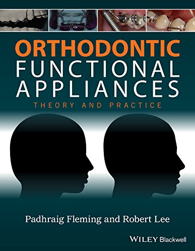 9781118670576-uk Orthodontic Functional Appliances: Theory and Practice - Image 1
