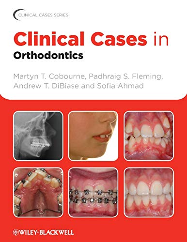 9781405197793-uk Clinical Cases in Orthodontics - Image 1