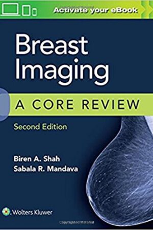 Breast Imaging: A Core Review