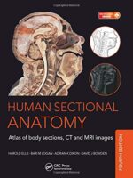 Human Sectional Anatomy: Atlas of Body Sections, CT and MRI Images