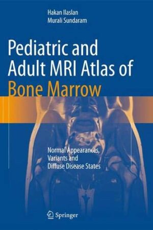 Pediatric and Adult MRI Atlas of Bone Marrow: Normal Appearances, Variants and Diffuse Disease States